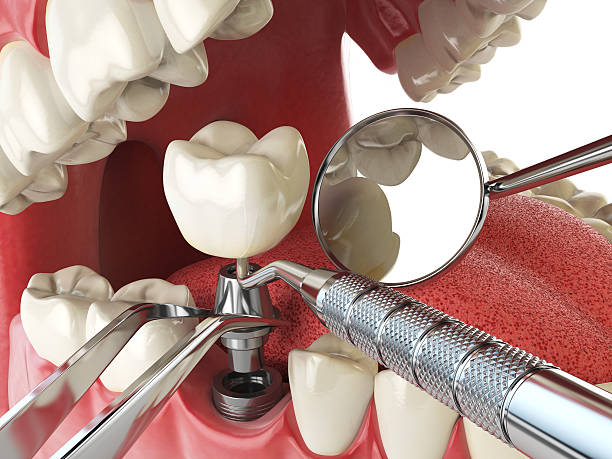 Best Dentist for Severe Toothache  in Harlem, FL